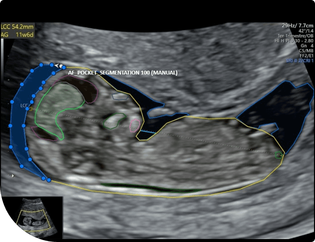AI-Powered Fetal Annotation by Logictive Solutions